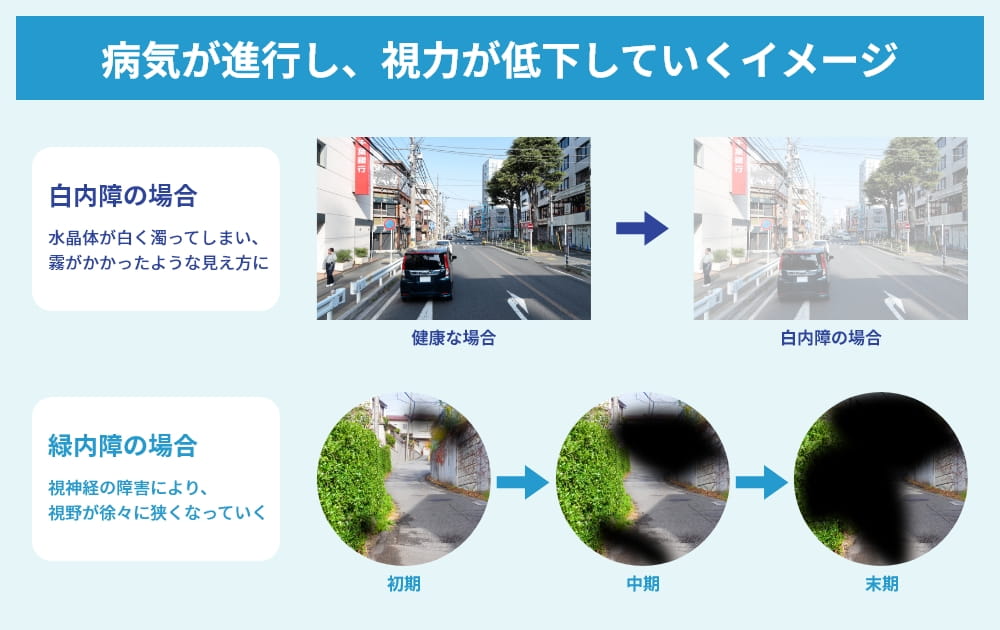 視力が低下していくイメージ