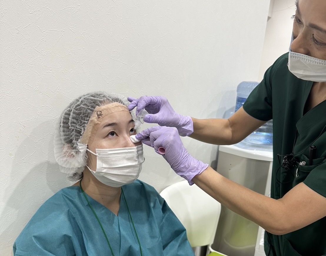 医師に目薬をしてもらっている女性