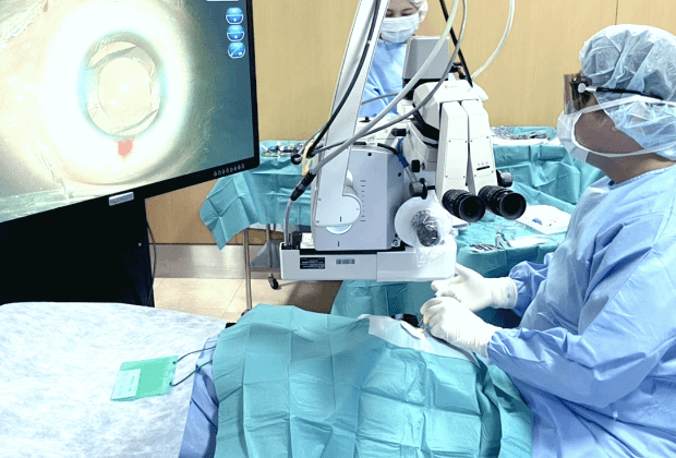  ICLの手術の様子