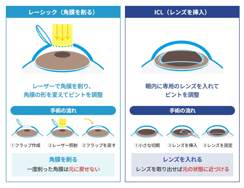 レーシックとICLの違い