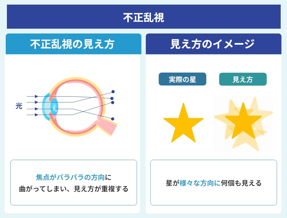 不正乱視の見え方