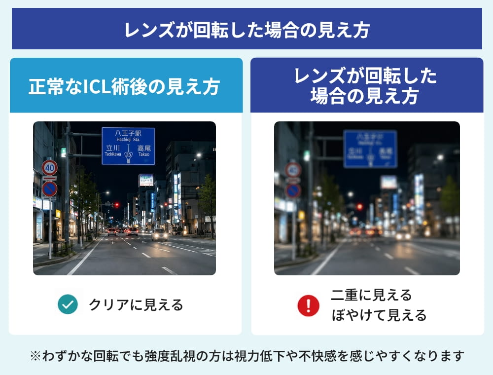 乱視用ICL手術後の見え方比較