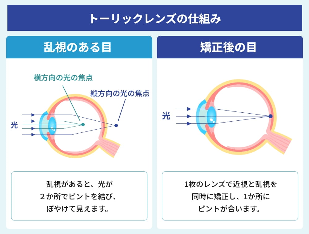 トーリックレンズの仕組み
