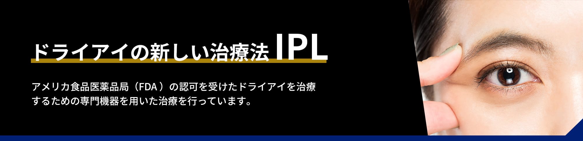 ドライアイの新しい治療法IPL
