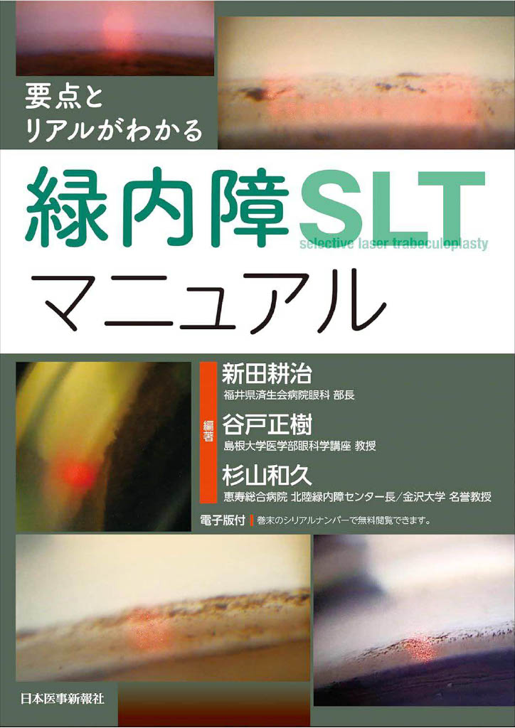 要点とリアルがわかる緑内障SLTマニュアル 日本医事新報社編集:新田耕治、谷戸正樹、杉山和久分担執筆:山本雅、今野公士