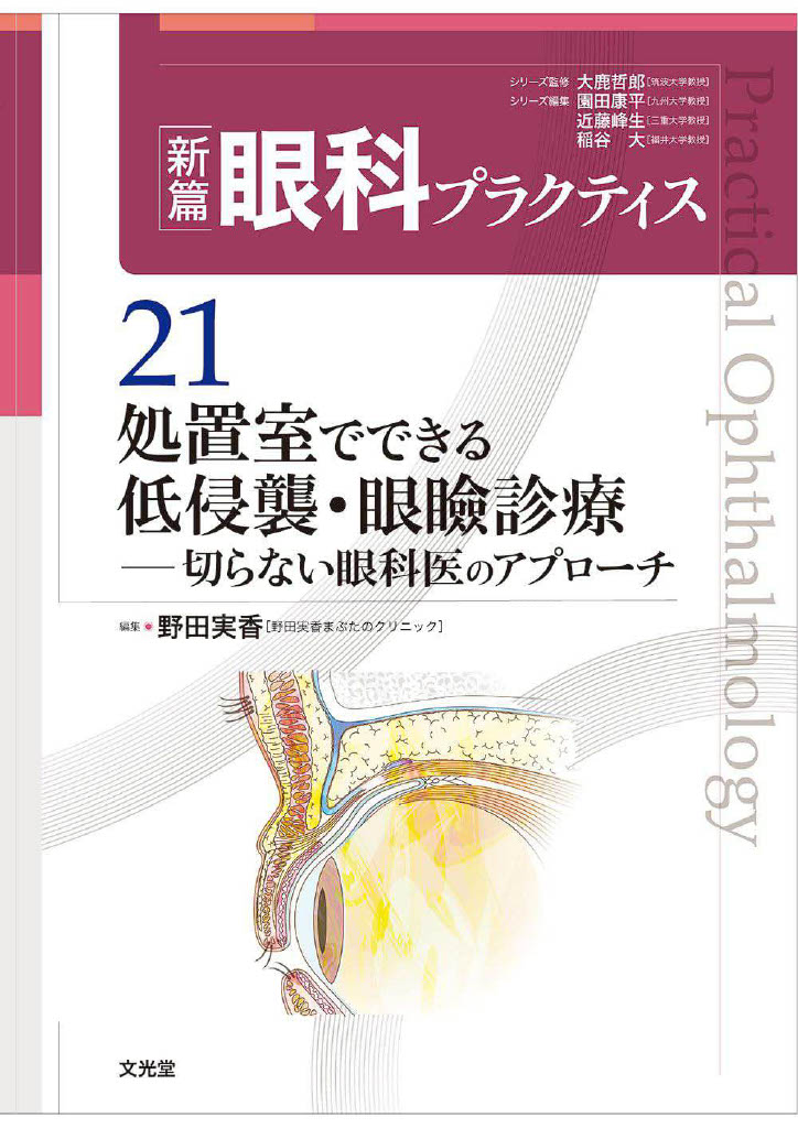 新篇眼科プラクティス21処置室でできる低侵襲・眼瞼診療 One Point Advice:眼瞼下垂術後のドライアイのケア 野田実香　編集: 文光堂分担執筆: 山田健司、今野公士